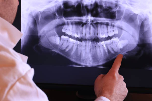 Best Emergency Dental Surgery in Batesville, IN