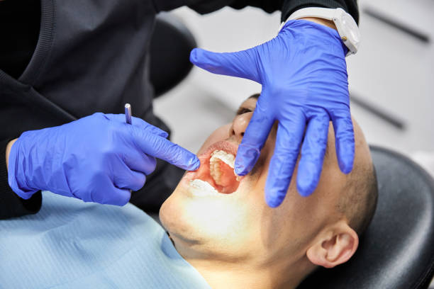 Best Emergency Tooth Extraction in Batesville, IN